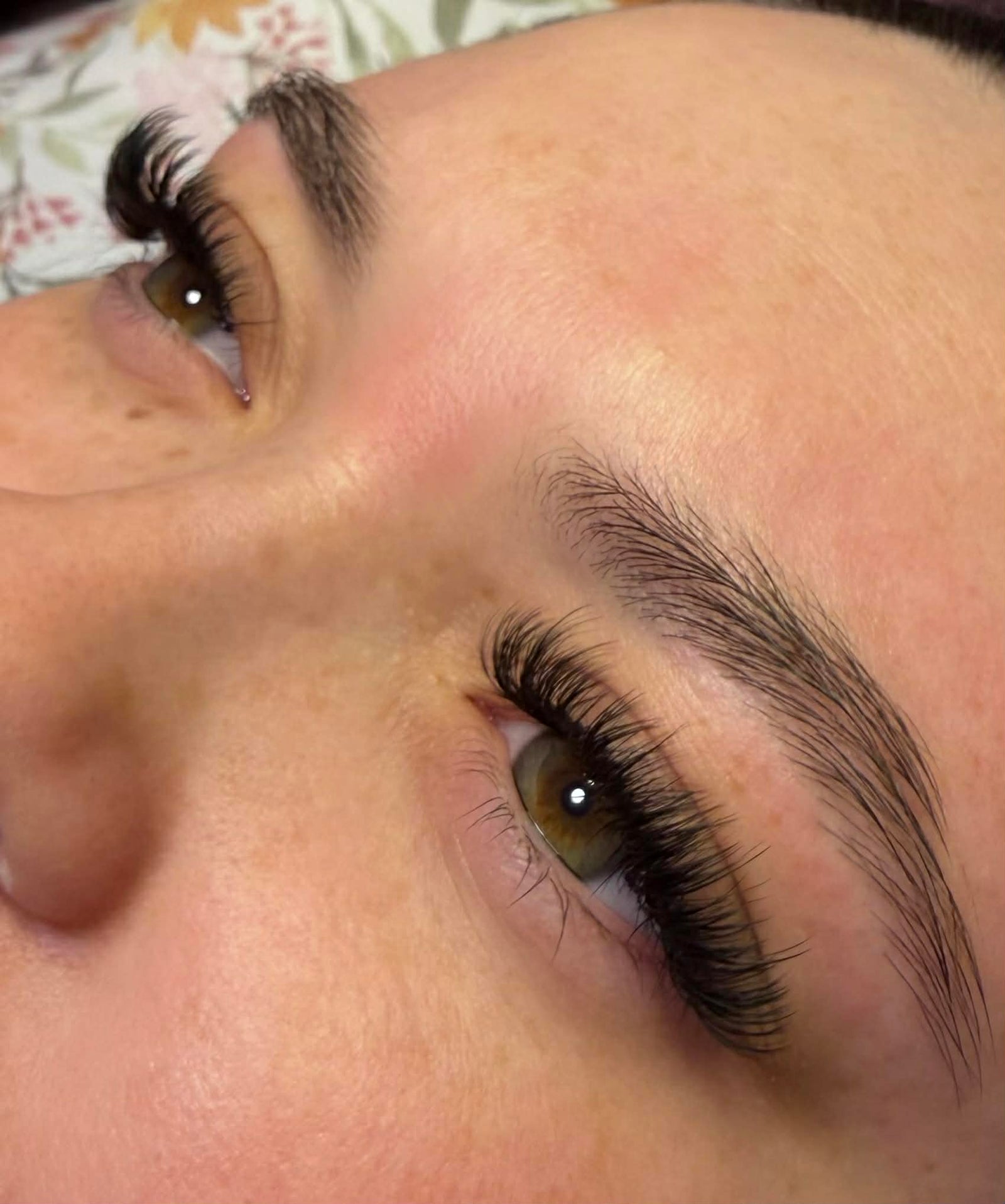 Skincare Treatments That Actually Make a Difference